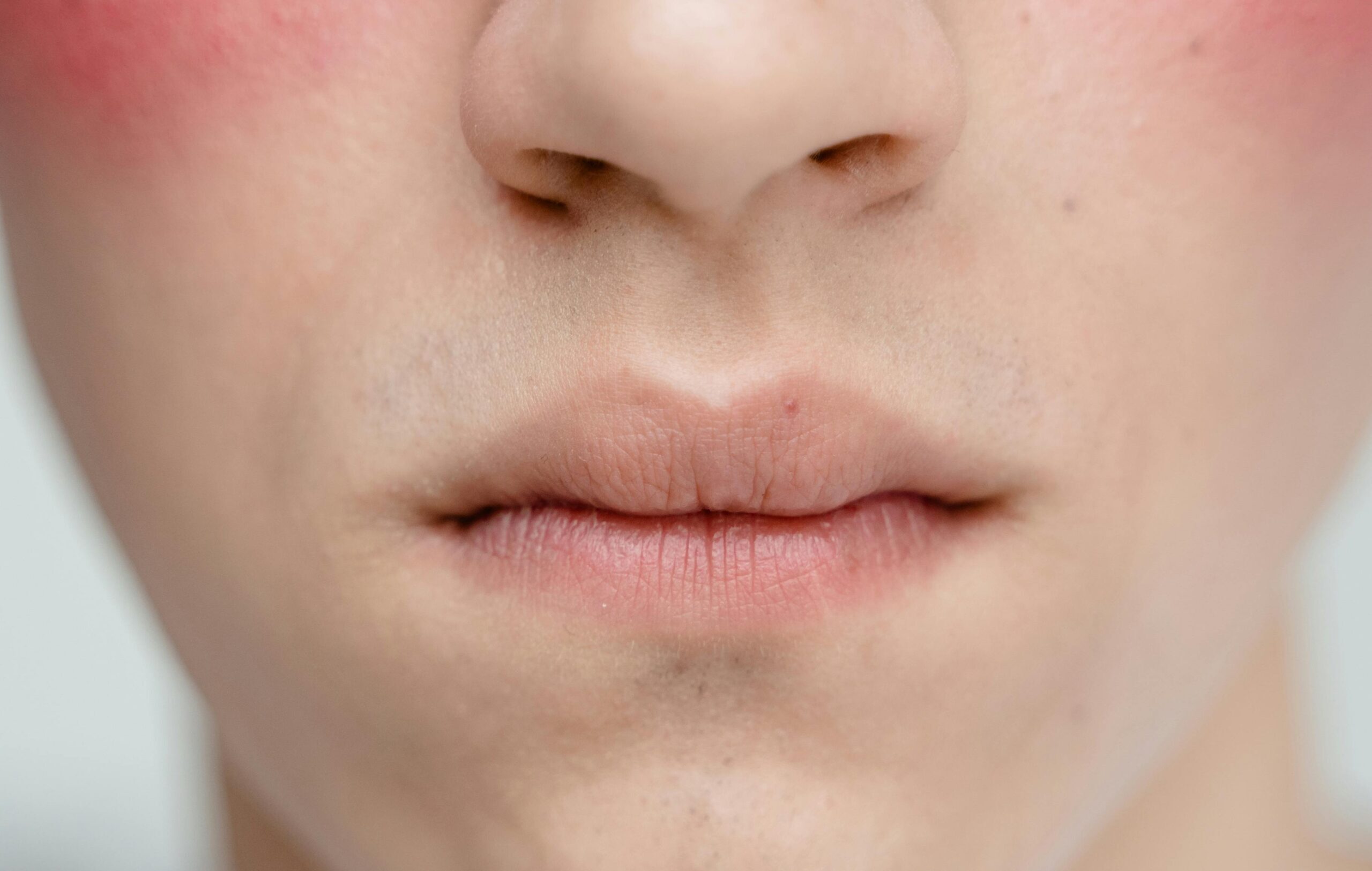 Why Your “Sensitive Skin” Might Actually Be Damaged Skin