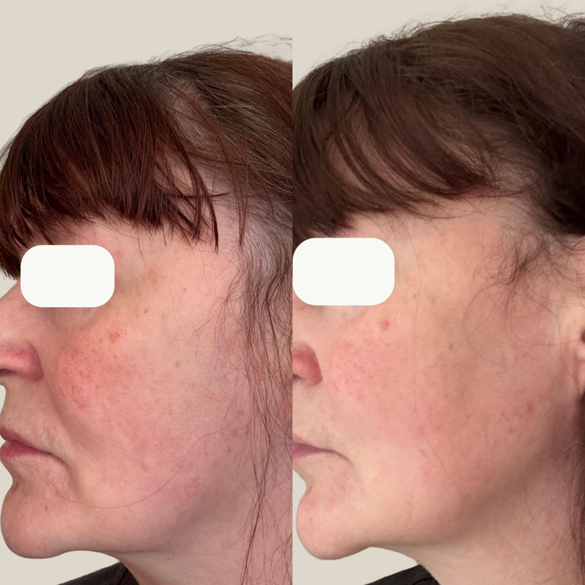 Brighter, calmer complexion result