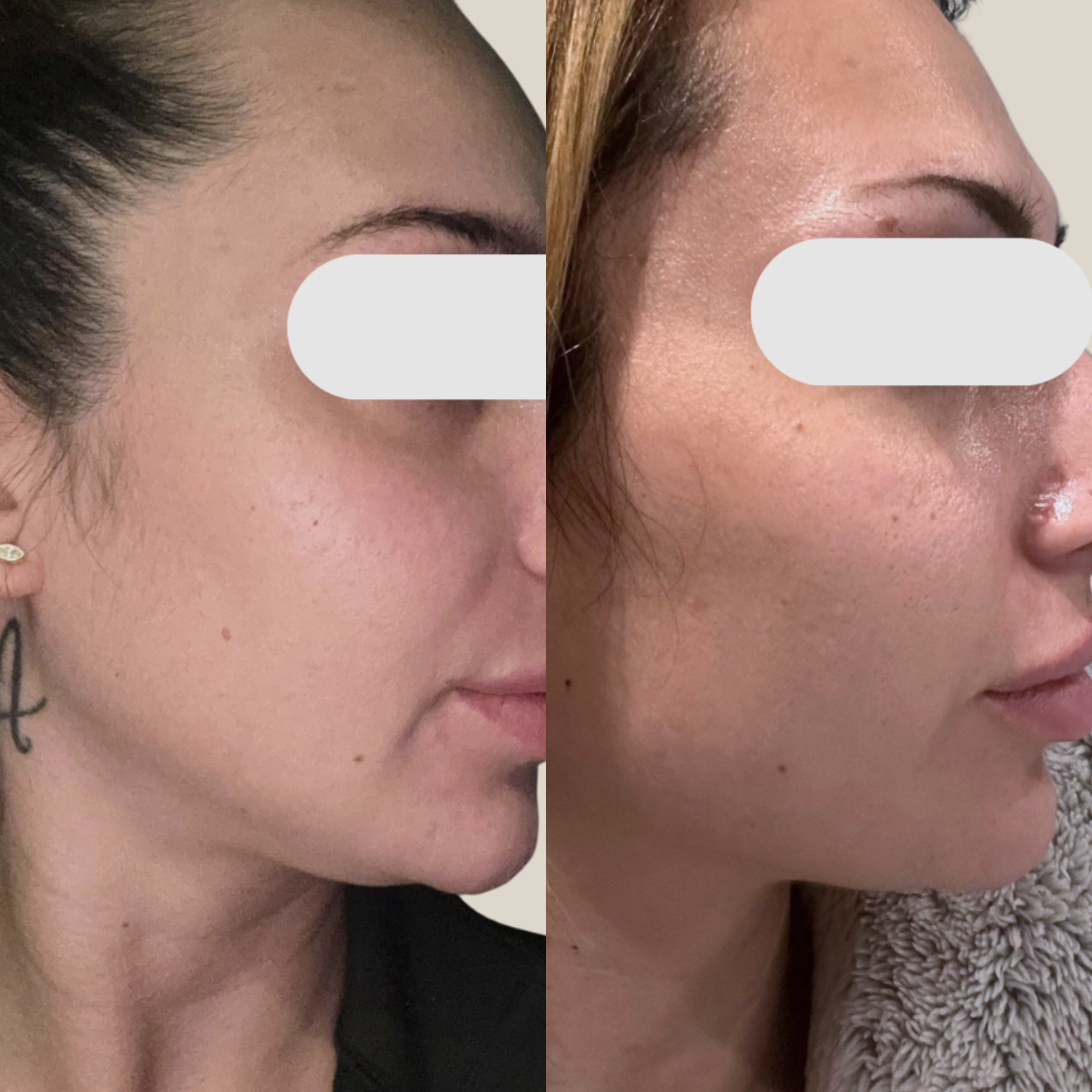 Clearer, more balanced skin result